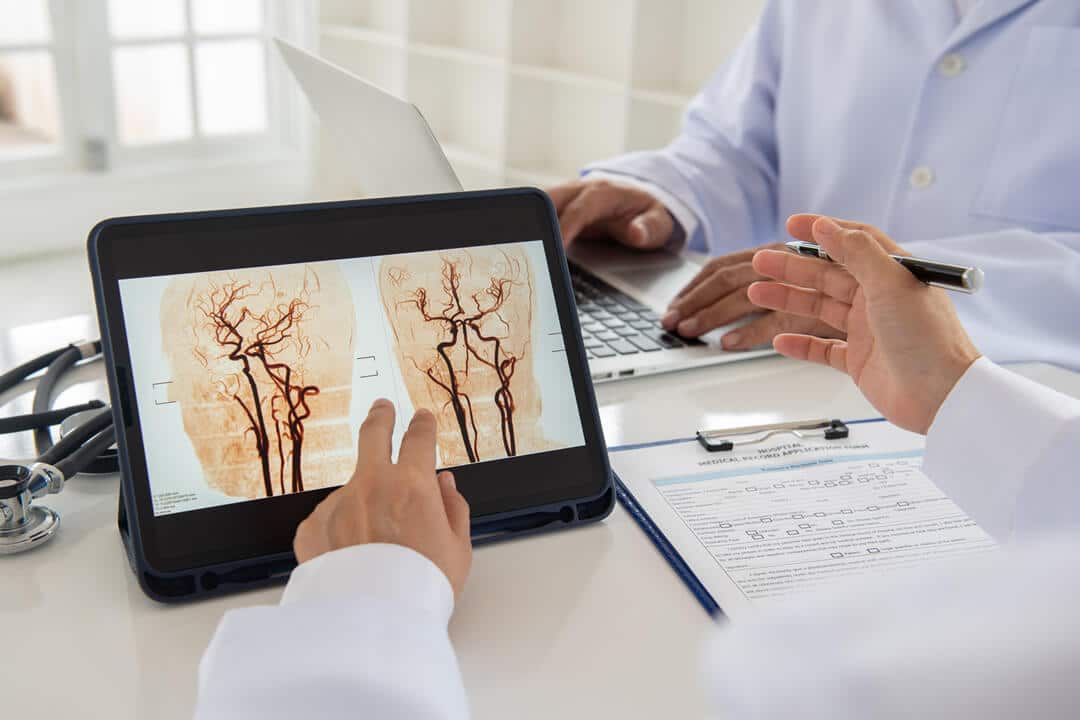 Receiving Social Security Disability for an Aneurysm